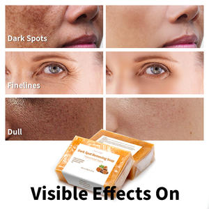 Grosir perawatan kulit organik alami Anti jerawat pemutih pencerah titik hitam nikotinamida asam Kojic sabun kunyit - Product Image 4