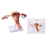 Modelo de Útero Femenino para Patología, Anatomía Médica, para Médicos y Estudiantes