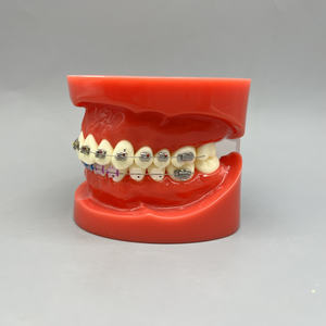 แบบจำลองการแสดงผลอุปกรณ์จัดฟันอุปกรณ์จัดฟันเครื่องช่วยสอนเปรียบเทียบโลหะ/เซรามิกสำหรับการสื่อสารระหว่างแพทย์คลินิกโรงพยาบาลผู้ป่วย - Product Image 5