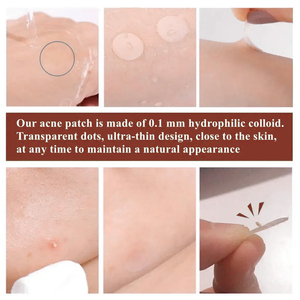 Patch anti-acné transparent à l'huile d'arbre à thé personnalisé, patch anti-acné hydrocolloïde imperméable pour couvrir l'acné - Product Image 3