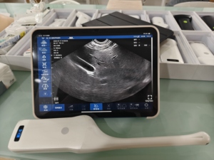 Ecógrafo Veterinario Portátil DMU92, Ginecología/Endovaginal, Wifi, Inalámbrico, Escáner Transvaginal para Humanos/Veterinarios - Product Image 4