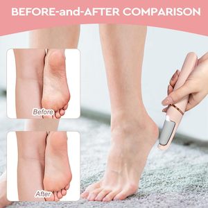 Dispositivo Eléctrico para Remover Callos y Exfoliar los Pies con Alimentación USB y Cabezales <span class=keywords><strong>de</strong></span> Repuesto para Pedicura - Product Image 2