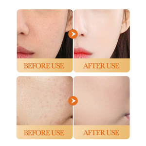 Beste Verkoop 150Ml Natuurlijke Organische Huidverzorging Gezicht Wassen Diepe Schone Porie Olie Controle Super Whitening Kurkuma Gezichtsreiniger - Product Image 6