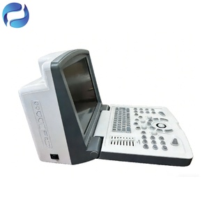 Échographe portable électrique pour grossesse, type ordinateur portable, pour cliniques, instruments d'échographie médicale avec garantie de <span class=keywords><strong>3</strong></span> ans - Product Image 2