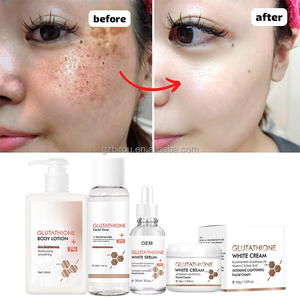 OEM ODM ชุดดูแลผิว <span class=keywords><strong>gluta</strong></span> Vitamin C Kojic Acid โลชั่นฟอกสีขาวช่วยทำให้กระชุดดูแลผิวกระจ่างใส - Product Image 1