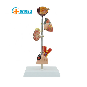 Model Anatomi Kaki Diabetik Ilmu Kedokteran Menunjukkan Pola <span class=keywords><strong>Diabetes</strong></span> Termasuk Pola Organ Patologis - Product Image 1
