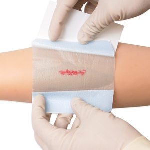 Huawell Cerotti Idrogel Sterili per Ustioni, Bende per Sollievo Istantaneo dal Dolore da Ustioni e Ferite Minori, Raffreddamento Immediato, Vendita all'Ingrosso - Product Image 6