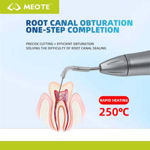 Nieuwe Tandheelkundige Guttapercha Cutter & Obturatiepen: Snel Opwarmend, Draadloos, Met Tips Voor Wortelkanaalvulling En Therapie - Product Image 3