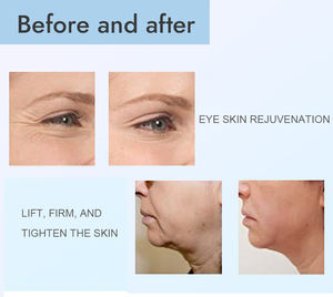 Nuevo multifuncional agua pura oxígeno Jet Peel Hydro <span class=keywords><strong>Facial</strong></span> <span class=keywords><strong>Aqua</strong></span> Peeling limpieza profunda máquina <span class=keywords><strong>Facial</strong></span> - Product Image 4