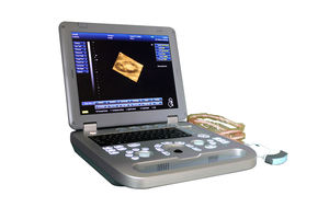 Mesin <span class=keywords><strong>Ultrasound</strong></span> Pemindai <span class=keywords><strong>Ultrasound</strong></span> Doppler Warna MSLCU17 - Product Image 3