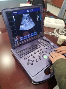 YSB-MU15V, harga grosir, pemindai <span class=keywords><strong>Ultrasound</strong></span>, diagnostik medis hewan <span class=keywords><strong>Ultrasound</strong></span>, warna portabel - Product Image 4