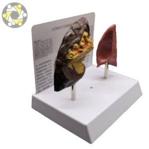 मानव फेफड़े चिकित्सा शिक्षण एनाटॉमी मॉडल - Product Image 5