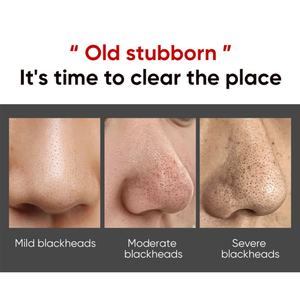 Lot de 10 autocollants peel-off pour le nez, nettoyage en profondeur, élimination des points noirs, bandes de charbon pour le nez - Product Image 4