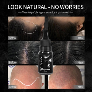 <span class=keywords><strong>Micropigmentación</strong></span> Tatuaje Tinta Cuero cabelludo Micro Pigmento Maquillaje permanente Cabello Tatuaje Tinta - Product Image 5