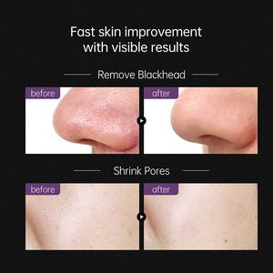 Crème <span class=keywords><strong>pour</strong></span> le nez éliminant les points noirs de marque privée zone T masque nasal déchirant propre et crème de masque <span class=keywords><strong>pour</strong></span> le visage contre l'acné - Product Image 6