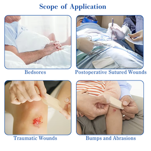 Hysent 5g şeffaf yapışkan PU <span class=keywords><strong>Film</strong></span> 10x10cm tıbbi ada tıbbi silikon için hidrokolloid malzeme vücut yara pansuman - Product Image 6