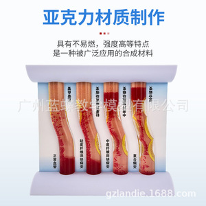 Modèle de simulation vasculaire d'occlusion et d'hyperlipidémie ; dynamiques pathologiques de l'athérosclérose et de la thrombose artérielle ; - Product Image 4