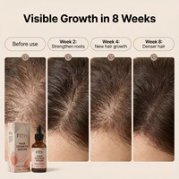 Sérum Capillaire Croissance Peptides Extraits Végétaux Naturels Biotine Romarin Soin Nourrissant du Cuir Chevelu Sans Prostaglandine Marque Privée Vente en Gros