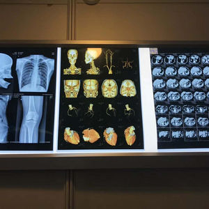 Mavi mürekkep püskürtmeli tıbbi kuru Film CT <span class=keywords><strong>DR</strong></span> MRI X Ray mavi şeffaf Film - Product Image 3
