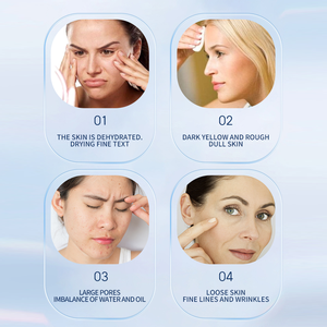 Crème hydratante pour le visage avec acide hyaluronique extrait de rose hyaluronate de sodium hydratant en profondeur crème de soin nourrissante et lissante pour la peau - Product Image 2