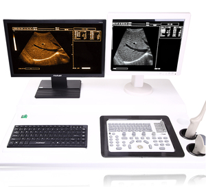 Escáner <span class=keywords><strong>de</strong></span> Ultrasonido Veterinario Tipo Carro con Doble Monitor y Estación <span class=keywords><strong>de</strong></span> Trabajo con Ecografía Doppler a Color - Product Image 2