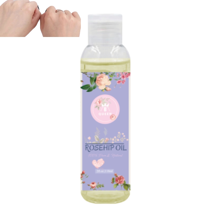 BeQueen Rose Hip Oiloil Rose Oil Serum Label Oils For Skin Whitening Organic