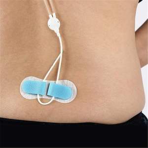 Perangkat keamanan kateter steril PICC/ CVC sekali pakai, perangkat fiksasi tabung bedah medis fidsi kateter IV - Product Image 2