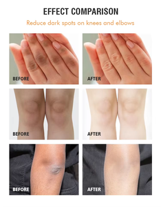 Soins <span class=keywords><strong>de</strong></span> la peau élimination des cicatrices rebondies anti-rides hydratant raffermissant 100% naturel CURCUMA OMEGA-3 GLOW BODY OIL - Product Image 6