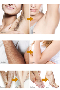 Espuma Depilatoria en Aerosol, Fórmula Nueva con Ingredientes 100% Naturales, Efectiva e Indolora para el Cuerpo y Zonas Íntimas - Product Image 6
