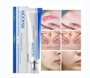 Etkili skar kaldırma yüz kremi akne sivilce streç işaretleri kaldırmak jel yumuşatma sıkılaştırıcı Anti streç işaretleri skar onarım krem - Product Image 2