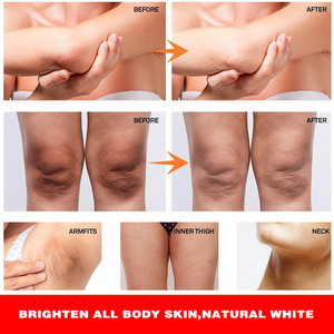 Khớp đen làm sạch kem massage khuỷu tay đầu gối mắt cá chân cổ mông khu vực tư nhân melanin vẻ đẹp sản phẩm chăm sóc cá nhân mỹ phẩm - Product Image 5