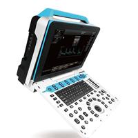 Machine portative d'ultrason d'instruments médicaux d'ultrason d'ultrason d'ultrason de Longermay vétérinaire