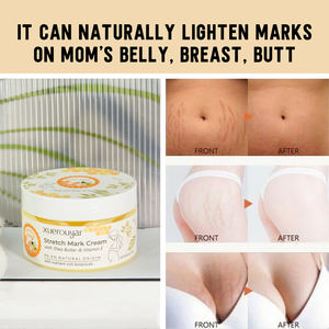 OEM ODM Vente en gros Beurre de karité Corps de femmes <span class=keywords><strong>Grossesse</strong></span> Traitement des vergetures <span class=keywords><strong>Huile</strong></span> de réparation Dissolvant de cicatrices Crème pour les vergetures - Product Image 3