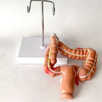 Modèle de maladie du côlon et du rectum humain KyrenMed, modèle pathologique de l'intestin grêle