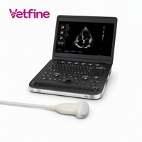 Appareil d'échographie Doppler couleur portable, scanner d'échographie couleur de type ordinateur portable, écran HD de 15,6 pouces avec 3D 4D pour utilisation hospitalière