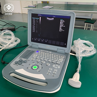 Échographe vétérinaire portable haute résolution, examen de grossesse, HD LIVE, Doppler couleur cardiaque, vente chaude
