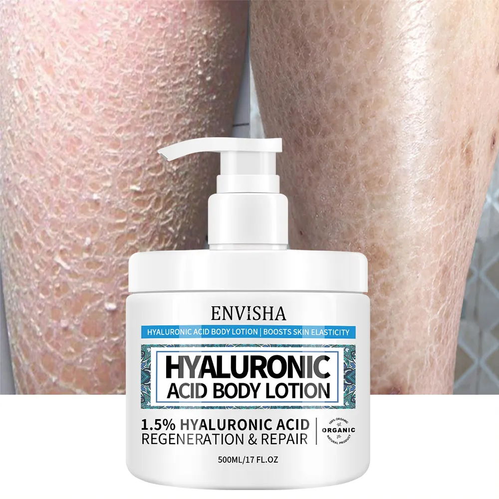 Private Label Moist urizing Repair ing Hyaluron säure Gesicht Körper lotion Schlagsahne Körper butter Für Männer Frauen Trockene Haut
