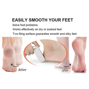 Hot Selling Natural Pumice Stone Pedicure Tools <strong>Remover</strong> for Feet and <strong>Hands</strong> Exfoliation to Remove Dead Skin - Product Image 3
