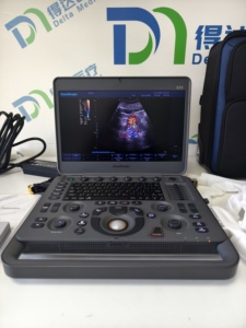 Échographe Doppler Couleur Portable Sonoscape X3V de Haute Qualité pour Usage Vétérinaire avec Prix Promotionnel - Product Image 4