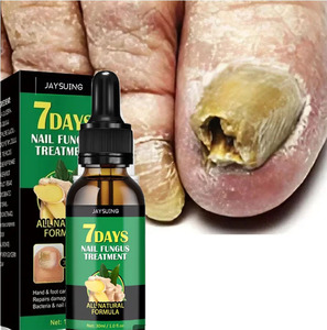 Solution de soin des ongles des orteils Essence naturelle des ongles Fix renouveler les moules endommagés ongles cassés fissurés ongles décolorés sérum de réparation rapide - Product Image 1