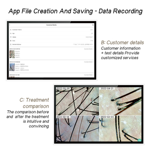 Meiboyi 14.1 인치 두피 분석기 터치 스크린 고급 데스크탑 헤어 스캐너 가정용 살롱 미용 도구 - Product Image 3