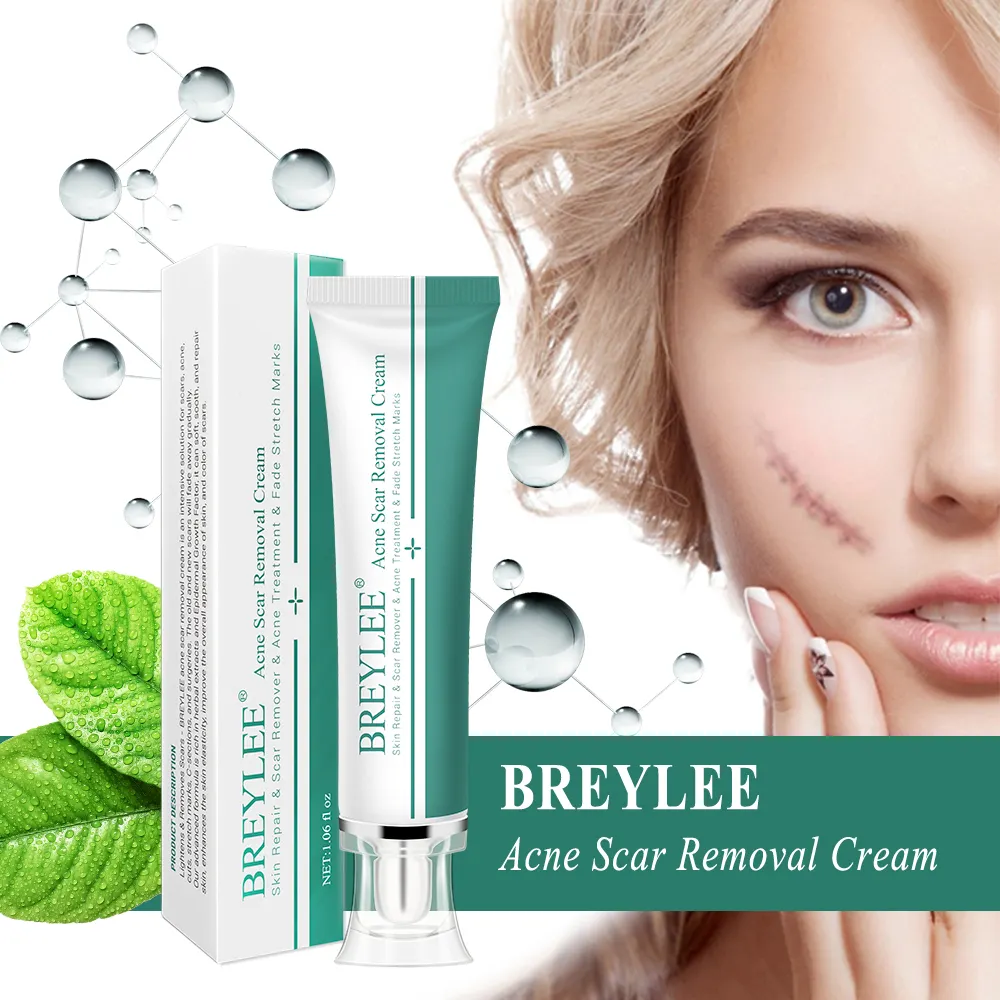 BREYLEE acne scar removal cream can reduce stretch marks