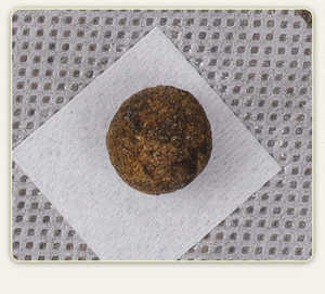 腹部痩身パッチ高速燃焼脂肪減量デトックス腹部へそステッカー湿気悪の除去胃を改善 - Product Image 2