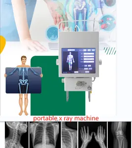 새로운 최신 판매 5.3 KW 휴대용 방사선학 엑스레이 기계 인간적인 수의사 디지털 방식으로