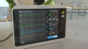हैंडहेल्ड Co2 Spco2 पशु चिकित्सा उपकरण निगरानी उद्देश्यों के लिए महत्वपूर्ण हस्ताक्षर मल्टीपैरामीटर मॉनिटर - Product Image 6