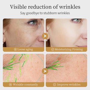 Crème contour des yeux coréenne hydratante anti-rides et raffermissante à la niacinamide FAYANKOU, marque privée, réparatrice et lissante - Product Image 5