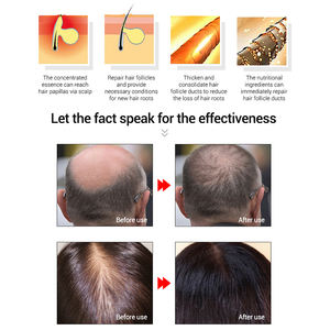 Champú y Acondicionador Natural Orgánico de Jengibre para el Crecimiento del Cabello y Contra la Caída del Cabello para Hombres y Mujeres - Product Image 4