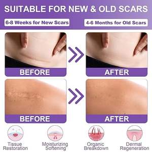 पुनः प्रयोज्य पारदर्शी सिलिकॉन निशान शीट कट चिपकने वाला स्टीकर रबर मास्किंग निशान की मरम्मत टेप प्रभावी घाव ड्रेसिंग के लिए - Product Image 4