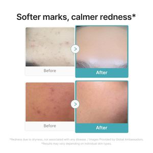 Sérum à l'acide azélaïque Medicube 10, 30 ml, traitement de l'acné du visage, sérum apaisant et clarifiant pour les peaux grasses - Product Image 5