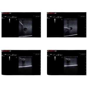 แบบจำลองการเจาะด้วยอัลตราซาวด์สำหรับการฝึกอบรมการรักษาด้วยอัลตราซาวด์บริเวณเต้านม พร้อมเนื้องอกโปร่งใส - Product Image 6